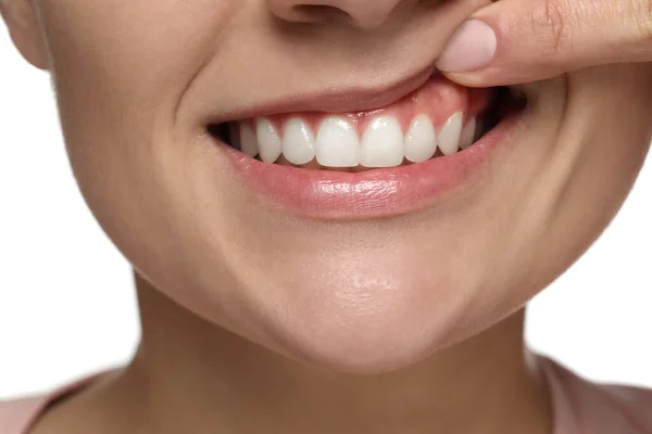 Frau Zeigt Gesundes Zahnfleisch Auf Weißem Hintergrund Nahaufnahme — Stockfoto