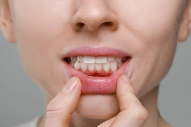 Gri arka planda sağlıklı diş etleri gösteren kadın, yakın plan.