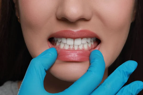 Läkare Handskar Undersöker Kvinnans Tandkött Närbild — Stockfoto