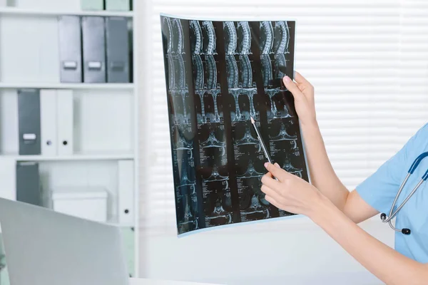Médico Examinando Imagen Resonancia Magnética Del Cuello Clínica Primer Plano — Foto de Stock