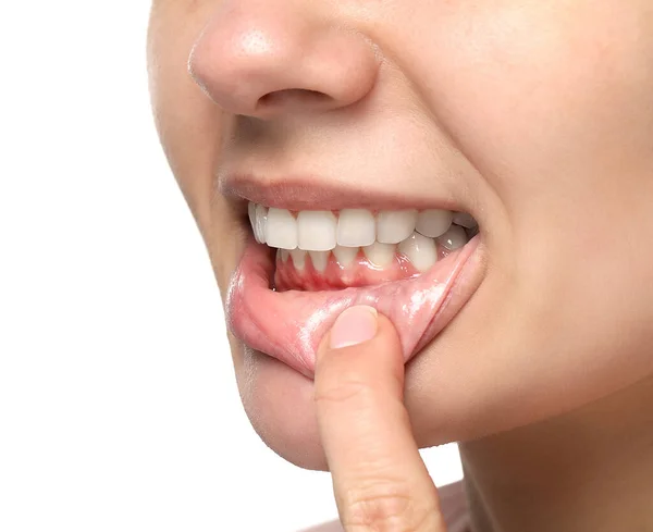 白い背景に健康な歯茎を示す女性 クローズアップ — ストック写真