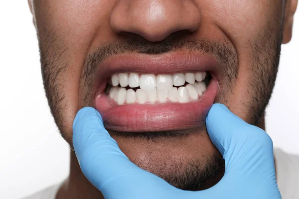 Zahnarzt Untersucht Das Zahnfleisch Des Mannes Auf Weißem Hintergrund Nahaufnahme — Stockfoto
