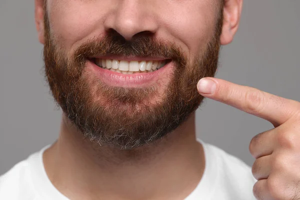 Man Showing Healthy Gums Gray Background Closeup — Stock Photo, Image
