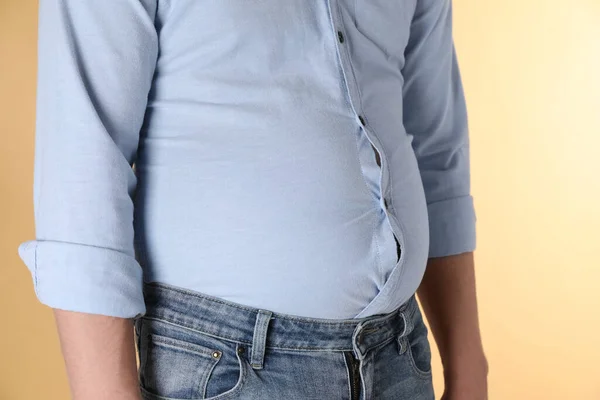 Übergewichtiger Mann Engen Hemd Auf Gelbem Hintergrund Nahaufnahme — Stockfoto