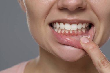 Gri arka planda sağlıklı diş etleri gösteren kadın, yakın plan.