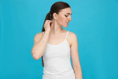 Açık mavi arka planda kızarıklık hastalığı virüsü olan bir kadın.