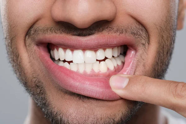 Mann Zeigt Gesundes Zahnfleisch Auf Grauem Hintergrund Nahaufnahme — Stockfoto