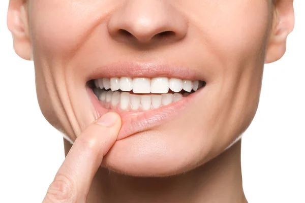 白い背景に健康な歯茎を示す女性 クローズアップ — ストック写真