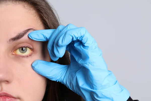 Médico Revisando Mujer Con Ojos Amarillos Sobre Fondo Claro Primer — Foto de Stock