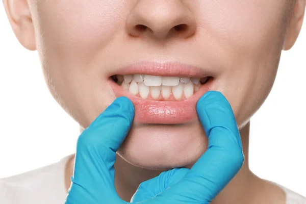 Läkare Undersöker Kvinnans Tandkött Vit Bakgrund Närbild — Stockfoto