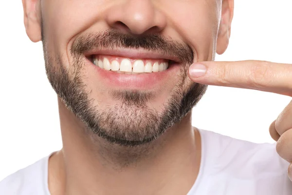 在白色背景上有健康牙龈的男人 特写镜头 — 图库照片