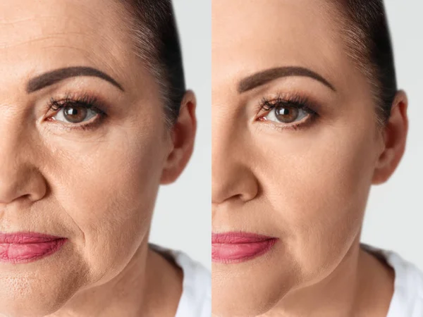 化粧品の手順のために女性が良く見えます 閉じます 若返りの前と後の白い背景の写真とコラージュ — ストック写真