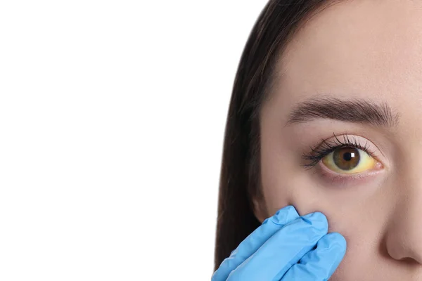 Dottore Che Controlla Donna Con Gli Occhi Gialli Sfondo Bianco — Foto Stock