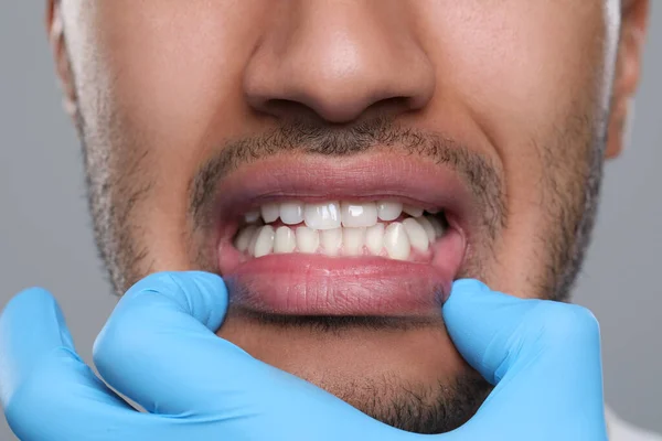 Zahnarzt Untersucht Das Zahnfleisch Des Mannes Auf Grauem Hintergrund Nahaufnahme — Stockfoto