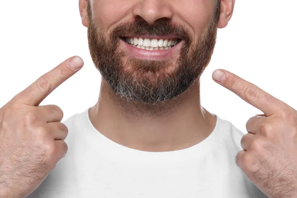 白い背景に健康な歯茎を示す男 クローズアップ — ストック写真