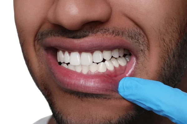 Zahnarzt Untersucht Das Zahnfleisch Des Mannes Auf Weißem Hintergrund Nahaufnahme — Stockfoto