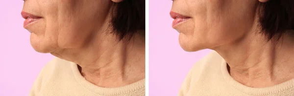 분홍색 배경에 피부를 강화하는 치료를 여성의 콜라주 클로즈업 — 스톡 사진