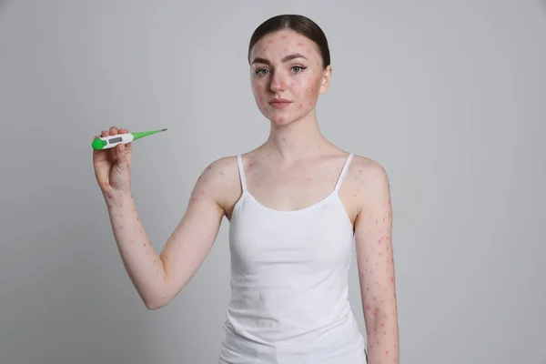 Woman Rash Holding Thermometer Light Grey Background Monkeypox Virus — Stock Photo, Image