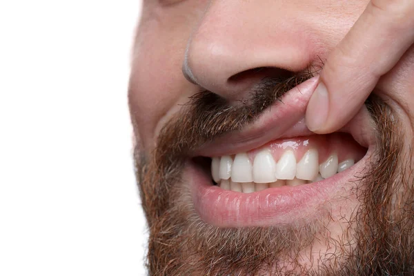 Man Showing Healthy Gums White Background Closeup — Stock Photo, Image