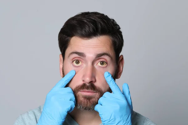 Dottore Che Controlla Uomo Con Gli Occhi Gialli Sfondo Grigio — Foto Stock