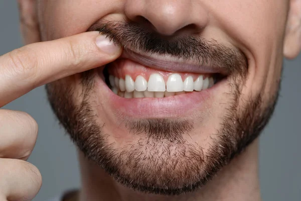 Man Showing Healthy Gums Gray Background Closeup — Stock Photo, Image