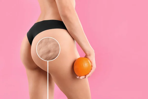 Cellulite Problem Slim Woman Underwear Holding Orange Pink Background Closeup — Stock Photo, Image
