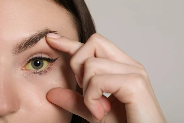 Kvinna Kontrollerar Hennes Hälsotillstånd Ljusgrå Bakgrund Närbild Gul Ögon Som — Stockfoto