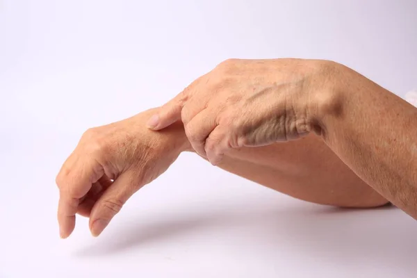 女性手部皮肤老化的特写镜头 — 图库照片