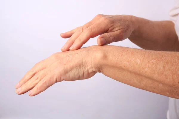 Vista Perto Das Mãos Mulher Com Pele Envelhecida — Fotografia de Stock