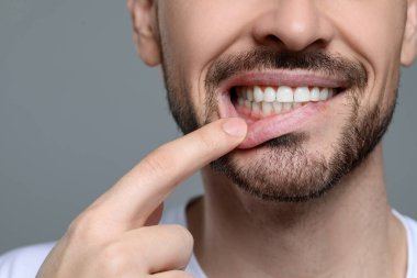 Gri arka planda sağlıklı diş etleri gösteren bir adam, yakın plan. Metin için boşluk