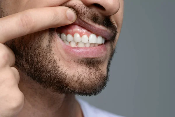 Mann Mit Gesundem Zahnfleisch Auf Grauem Hintergrund Nahaufnahme Raum Für — Stockfoto