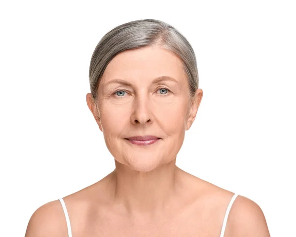 Retrato Mulher Idosa Com Pele Envelhecida Fundo Branco Tratamento Rejuvenescimento — Fotografia de Stock