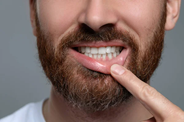 在灰色背景上有健康牙龈的男人 特写镜头 — 图库照片
