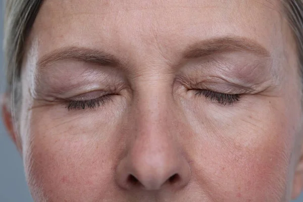 上了年纪的女人 皮肤灰白 康复治疗 — 图库照片