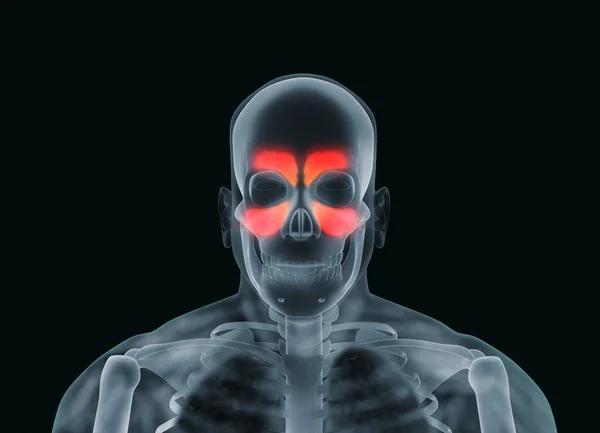 Röntgenbild Eines Mannes Mit Nasenhöhlen Auf Schwarzem Hintergrund Illustration — Stockfoto
