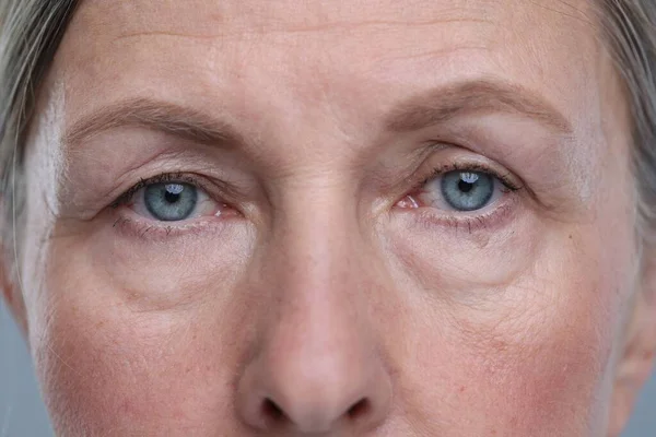 上了年纪的女人 皮肤灰白 康复治疗 — 图库照片