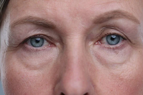 Closeup Άποψη Του Προσώπου Της Ηλικιωμένης Γυναίκας Γήρανση Του Δέρματος — Φωτογραφία Αρχείου