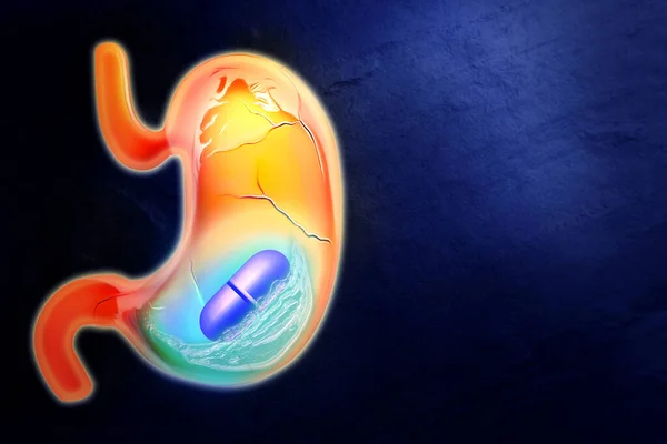 胸焼け治療 濃い青の背景にアンタチ酸錠剤と不健康な胃のイラスト テキストのためのスペース 治療の結果を象徴する水 — ストック写真