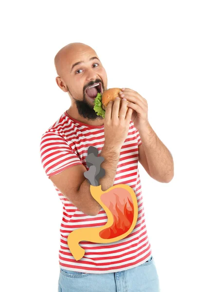 Alimentazione Impropria Può Portare Bruciore Stomaco Altri Problemi Gastrointestinali Uomo — Foto Stock