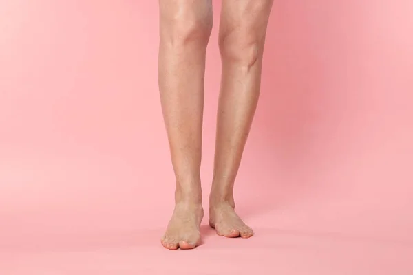 Closeup View Woman Varicose Veins Pink Background — Stockfoto