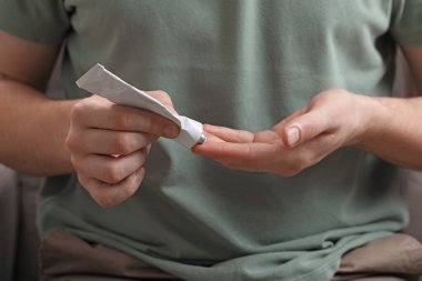 Merhem süren adam tüpten parmaklarına, yakın çekim