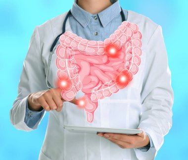 Gastroenterolog açık mavi arkaplanda tablet bilgisayarı tutuyor, yakın plan. Cihazın üzerinde benekleri olan bağırsakların görüntüsü
