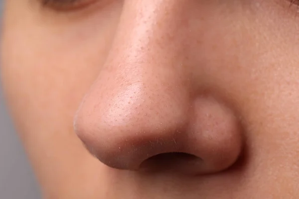 Young Woman Acne Problem Closeup View Nose — Stock Photo, Image