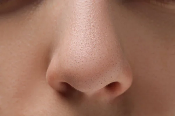 Молодая Женщина Акне Проблемы Крупный План Носа — стоковое фото