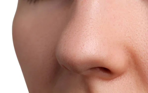 Młoda Kobieta Problemem Trądziku Białym Tle Widok Bliska Nosa — Zdjęcie stockowe