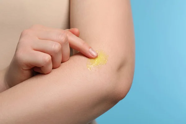 Woman applying ointment onto her arm on light blue background, closeup