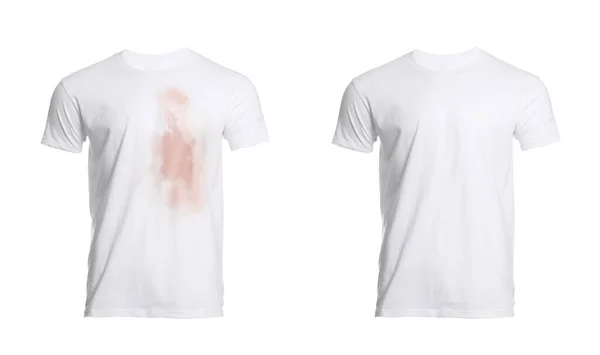 Collage Mit Schmutzigem Und Sauberem Shirt Isoliert Auf Weiß Vor — Stockfoto