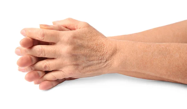 Closeup View Woman Hands Aging Skin — Stock Photo, Image