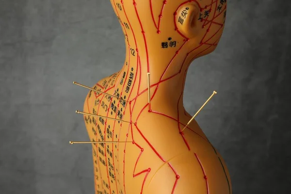 Acupuncture - alternative medicine. Human model with needles in shoulder against dark grey background