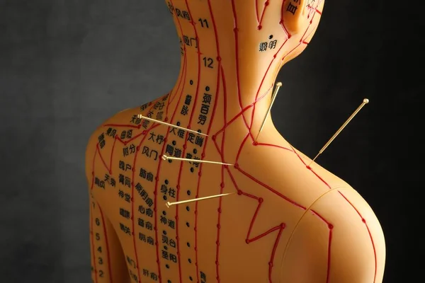 Akupunktura Medycyna Alternatywna Model Ludzki Igłami Ramieniu Ciemnoszarym Tle — Zdjęcie stockowe